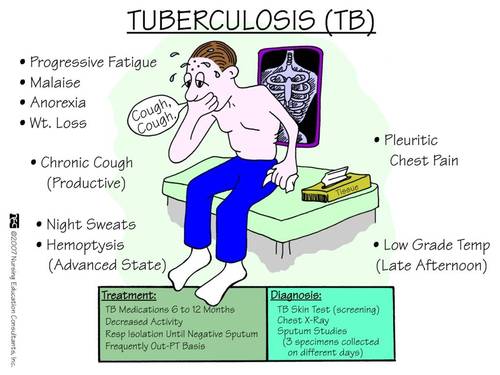 Tuberculosis Pictures