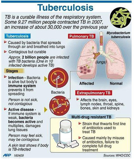 kmhouseindia: Tuberculosis Causes As Many Global Deaths As HIV/AIDS